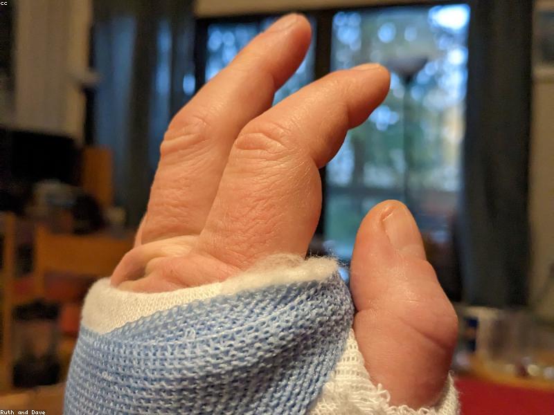 Try Wrist Guard Once Bowling — Form Fixes Faster
